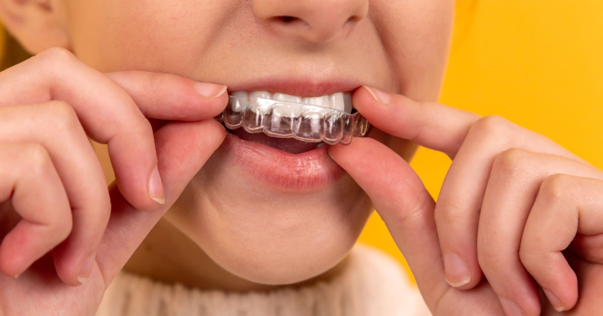 Dental implant model showing titanium post and porcelain crown